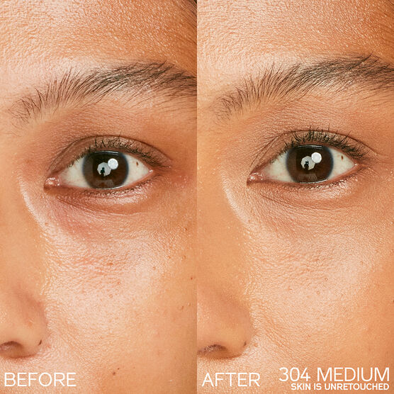 SHISEIDO SYNCHRO SKIN RADIANT LIFTING CONCEALER 304